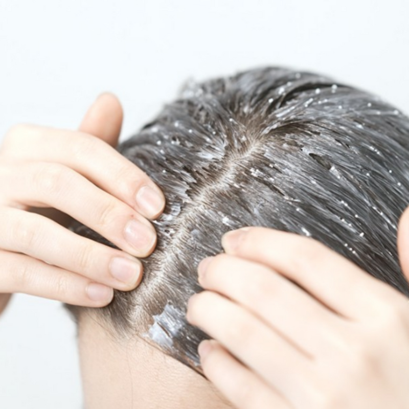 LABO-H Hair Loss Relief Capsule Treatment 220 ml