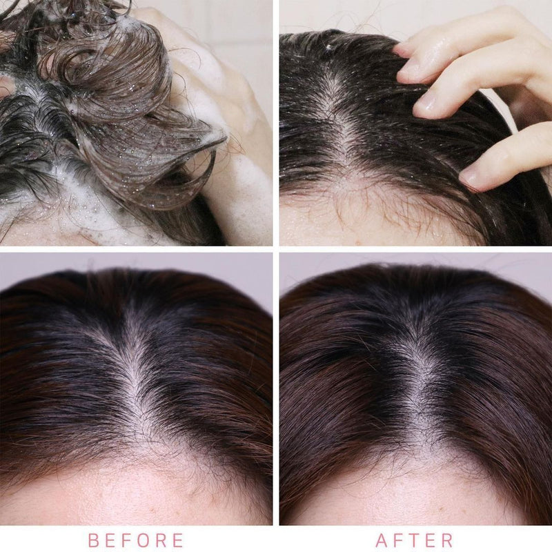 AYUNCHE Scalp Rebalancing Shampoo 500g.