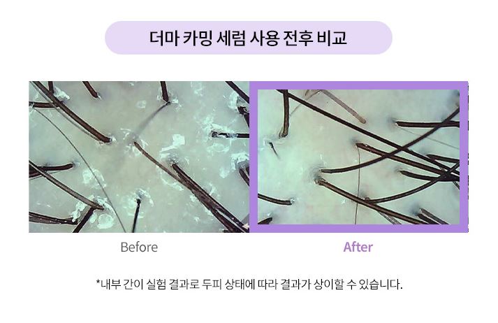 AYUNCHE Derma Calming Serum 80ml.