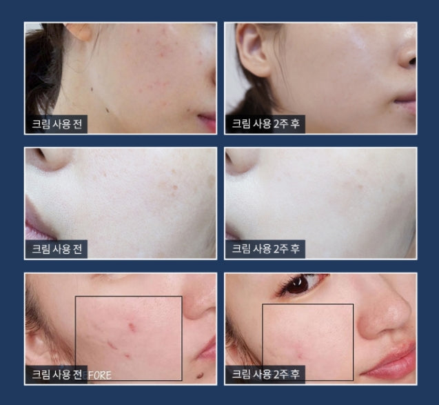 TONYMOLY Dr.OHKIMS+ SUCRATHENOL Recover Cream 50ml Korean skincare Kbeauty Cosmetics