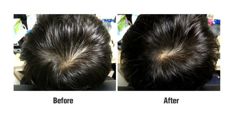 Caring scalp damaged, Comfortable, Youth, Activating, Natural
