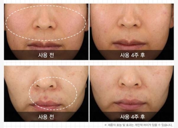 Nightingale Derma Cure Solution Teatamin Cream 60ml Korean skincare Kbeauty Cosmetic