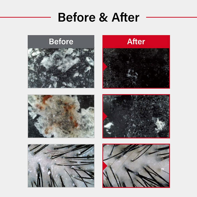 DR.FORHAIR Folligen Sea Salt Scaler 300g.