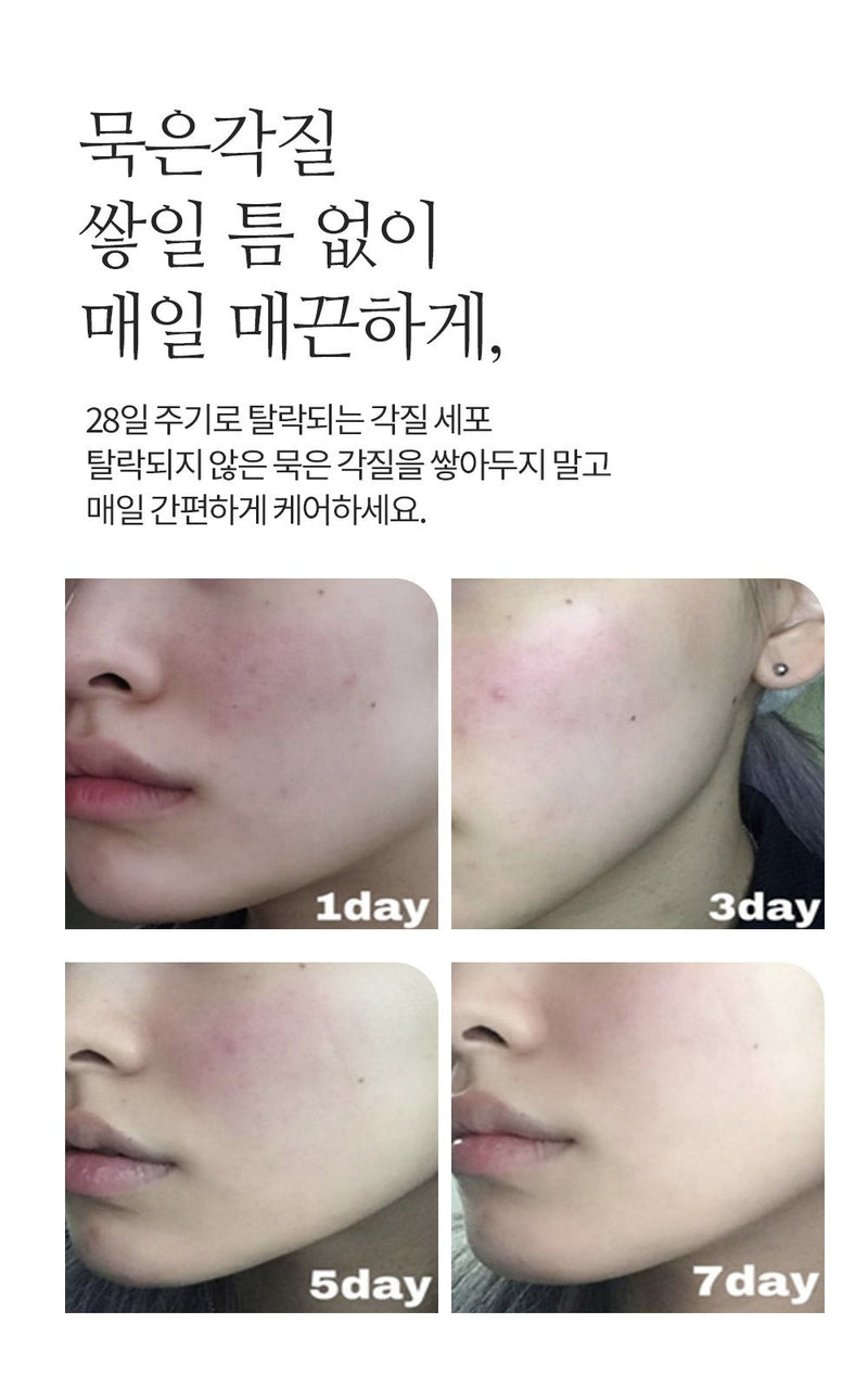 NOONI Daily Turnover Peel Pad 145ml.