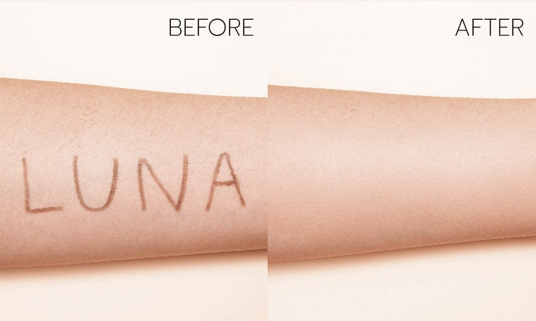 Before, After, Vitamin, Chamomilla, Imperfection