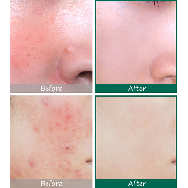 SOME BY MI AHA BHA PHA 30 Days Miracle Serum 50ml.