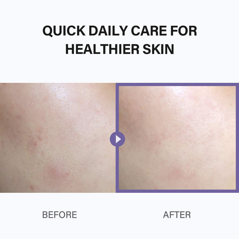 CELIMAX Ji Woo Gae Cica BHA Blemish Toner Pad 135ml 60ea.
