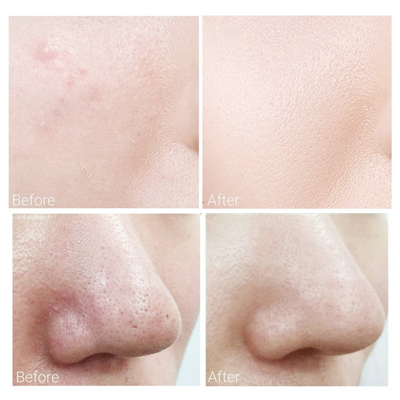 CNP Laboratory Invisible Peeling Booster 100ml.