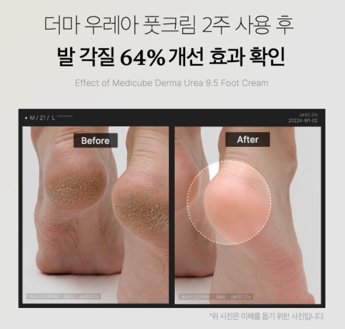 MEDICUBE Derma Urea 9.5 Foot Cream 50ml.