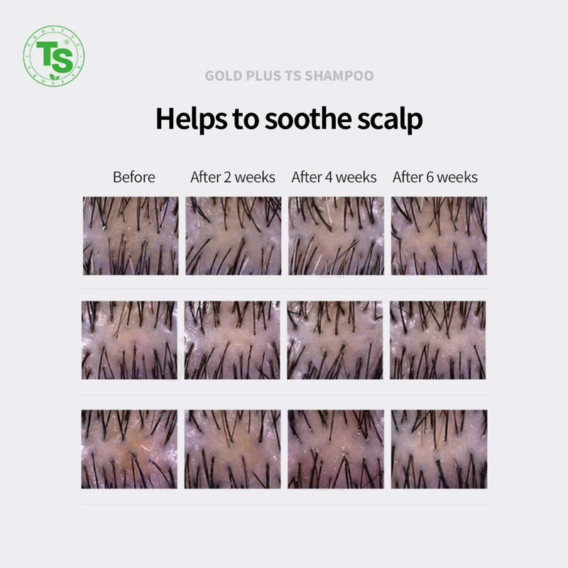 TS Gold Plus Shampoo 500ml.