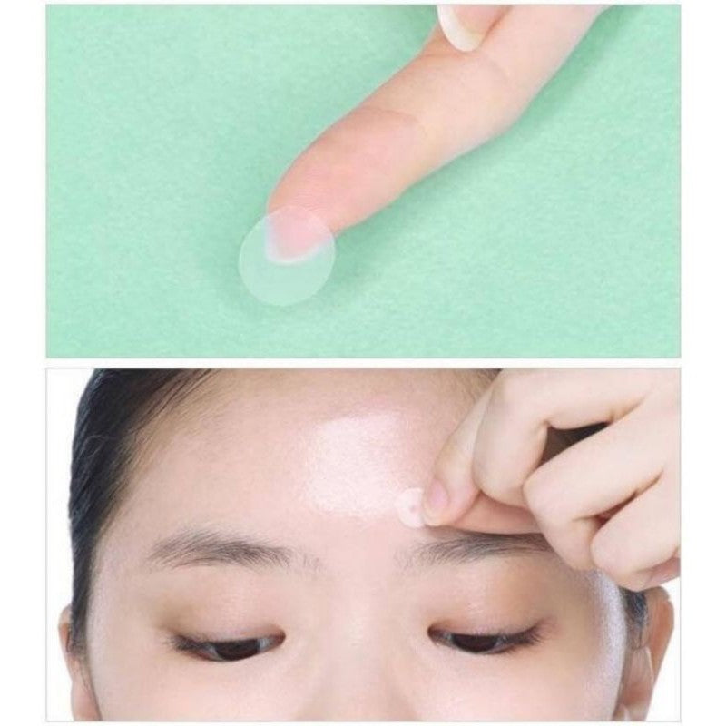 ETUDE HOUSE C Clean Up Spot Patch 5ea.