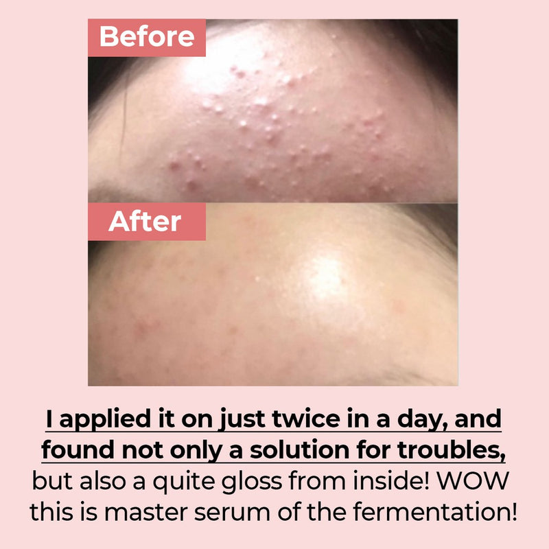 NUMBUZIN no.3 skin softening serum 50ml.
