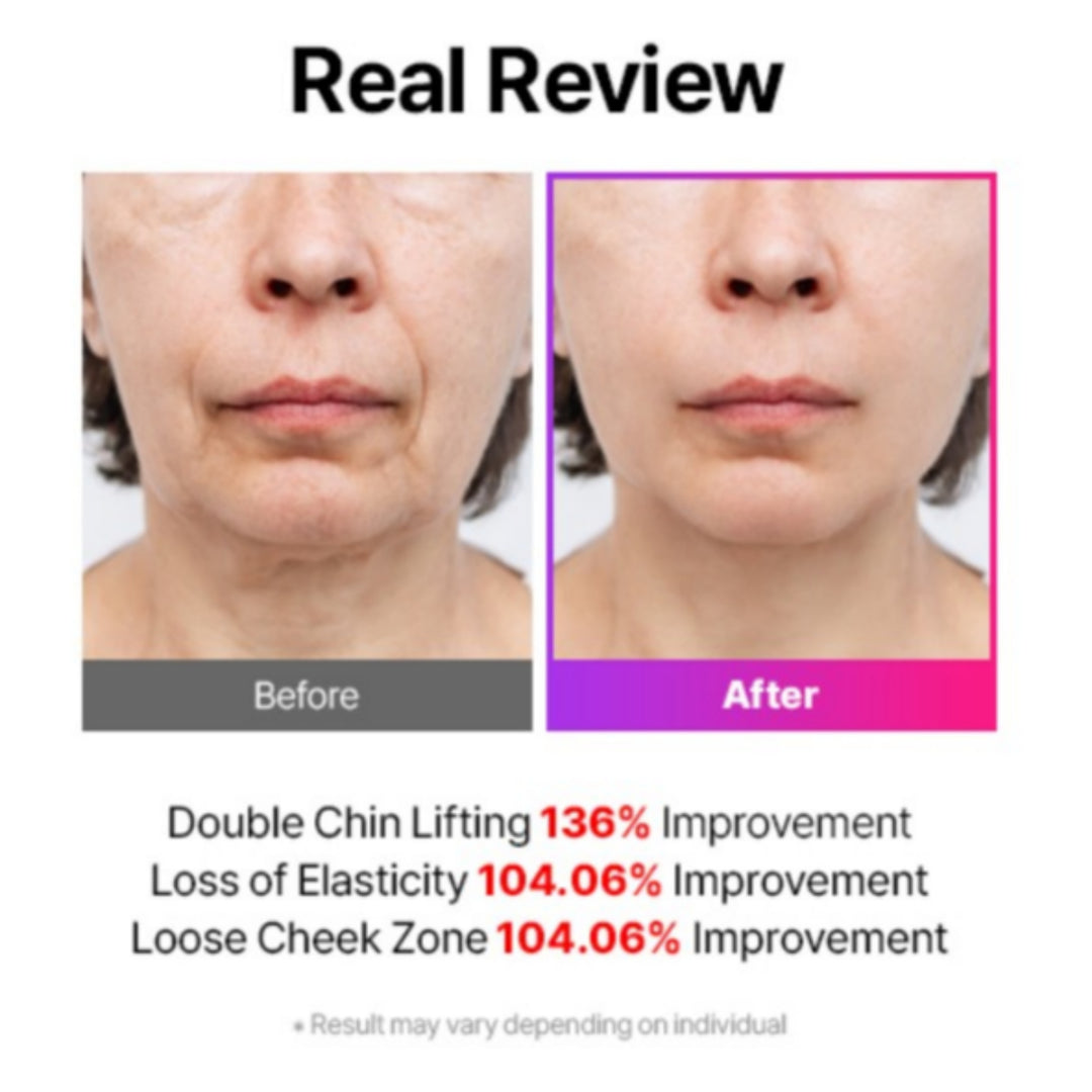 PINK EDITION] Mommy Care EMS V-THERA