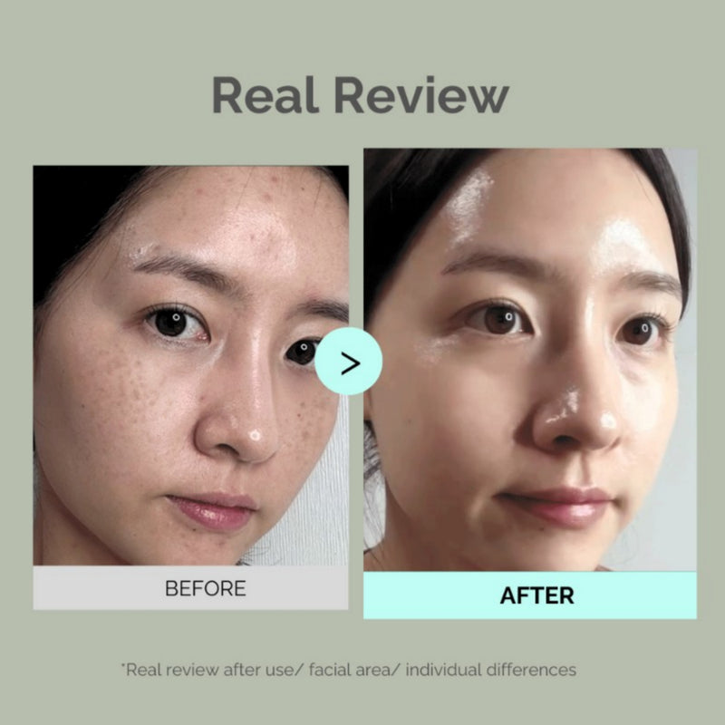Mommy Care Perilla Brightening Cream Plus 50g