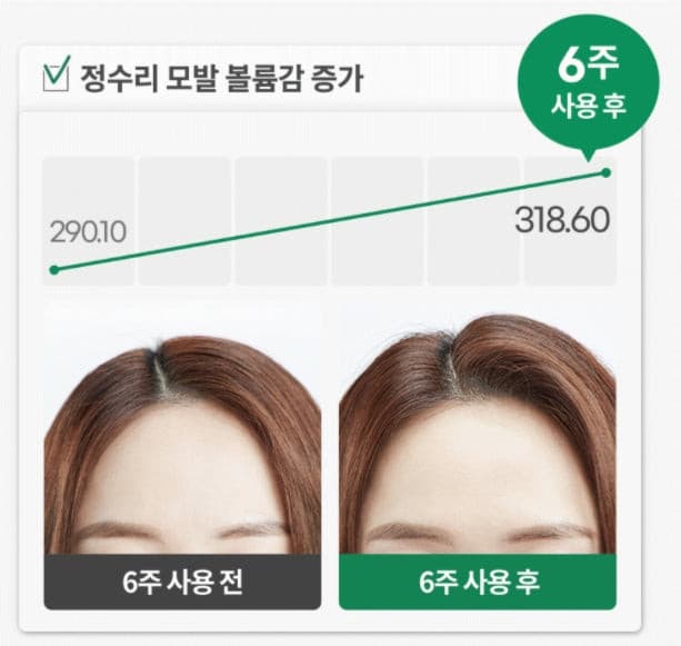 LABO-H Probiotics Hair Loss Relief Shampoo 400ml Korean haircare Kbeauty Cosmetics