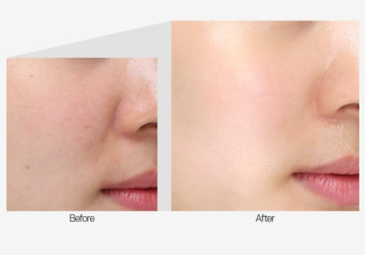 MEDI-PEEL Mezzo Filla Eye Serum 30ml – Korean Brightening & Wrinkle Care