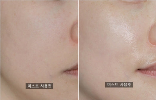 KIMJEONGMOON ALOE Cure Glow Ampoule Mist 100ml Korean skincare Kbeauty Cosmetic