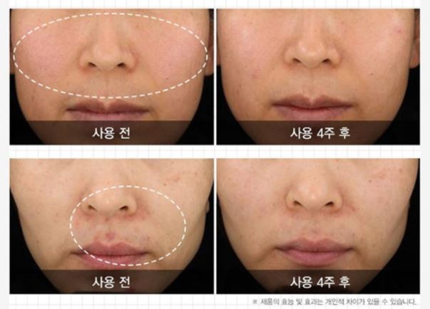 נייטינגייל דרמה קיור פתרון תטאמין קרם 60 מ"ל קוריאני לטיפוח העור Kbeauty קוסמטי