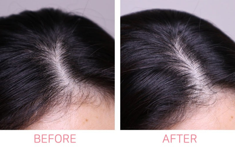 AROMATICA Rosemary Active V Anti-Hair loss Tonic 100ml.