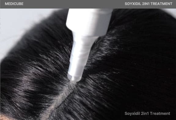 Medicube Soyxidil 2 in 1 Treatment 265ml Korean haircare Kbeauty Cosmetics